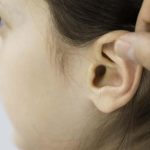 Çıkık kulaklar çocuklarda travmaya neden oluyor