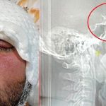 Bursa’da inanılmaz olay: Dişçiye gitti, hayatı kabusa döndü! Neredeyse ölüyordu