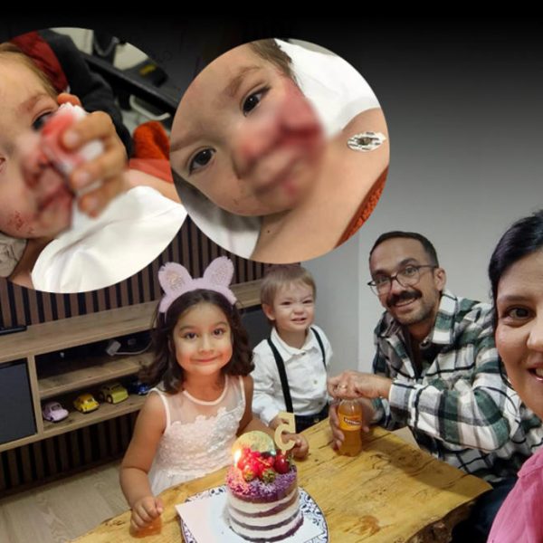 Ankara’da Pitbull Saldırısı: İki Çocuk Yaralandı, Sahibi Gözaltında!