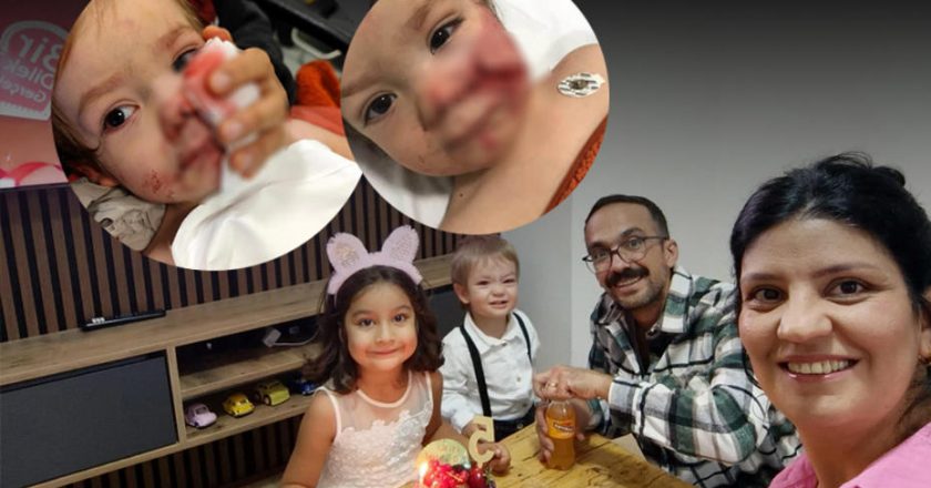 Ankara’da Pitbull Saldırısı: İki Çocuk Yaralandı, Sahibi Gözaltında!