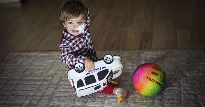 Pitbull saldırısının ardından minik Efe hastaneden çıktı